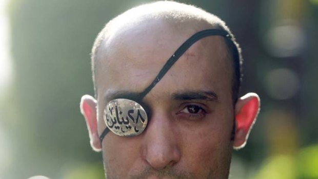 Ahmed El-Belasy, who was shot in the right eye during the revolution in January, takes part in a demonstration against police brutality in front of the Ministry of Interior building in Cairo.