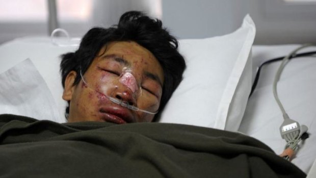 Dawa Tashi Sherpa survived the avalanche but remains in hospital.