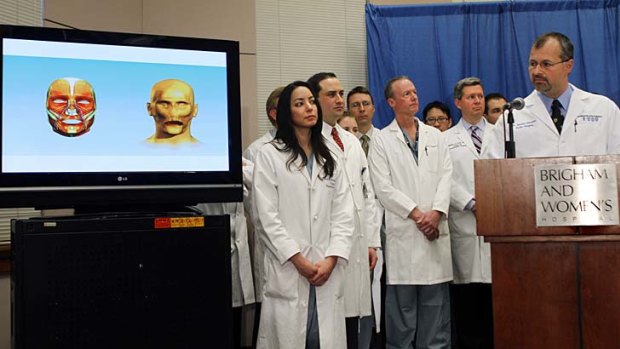 Plastic surgeon Dr Bohdan Pomahac, far right, explains the face transplant he performed.