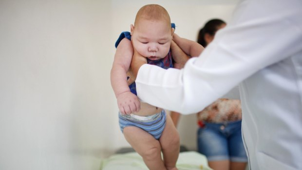 Five-month-old David Henrique Ferreira, who was born with microcephaly, is examined by a doctor on Monday in Recife, Pernambuco, Brazil. Ferreira's mother says she spends up to eight hours per day in transit on buses, three days per week, to visit a series of doctors with David. 