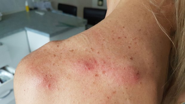 A female paramedic was allegedly assaulted at a Cairns backpacker hostel.