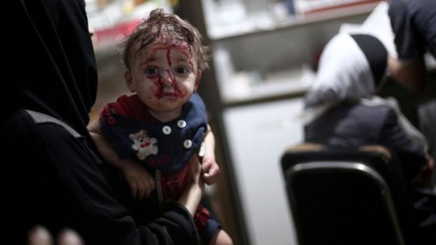 An injured child waits to be treated at a makeshift hospital following shelling by Syrian government forces in Douma, north-east of Damascus.
