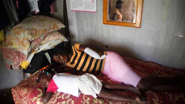 Sonia Donassien lies in bed with her four-year-old daughter Soleikah in Lascahobas, Haiti. Sonia had her arm amputated after it was crushed during the January 12 earthquake.