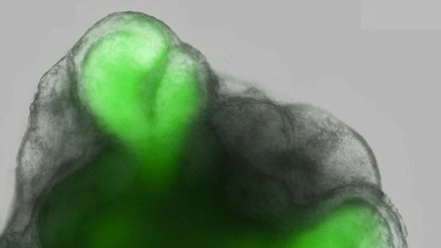 The green colour is fluorescence of GFP protein that was engineered to mark retinal tissue.