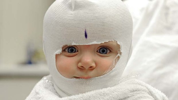 Looking forward: Elizabeth, 8 months, Helmet Clinic patient at Sydney Children's Hospital, Randwick.
