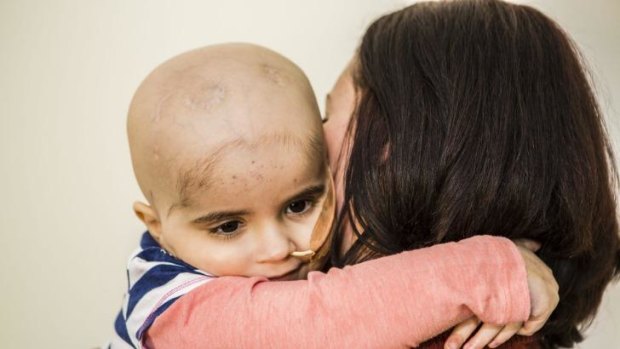 Annie McGuigan, 3, has endured months of treatment for brain cancer.