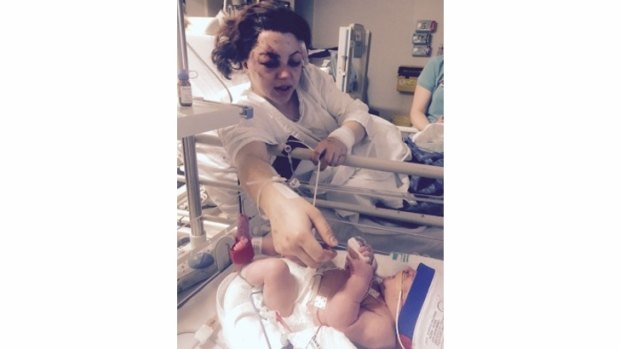 Felicity Jessop gave birth to her baby Tim after the crash.

