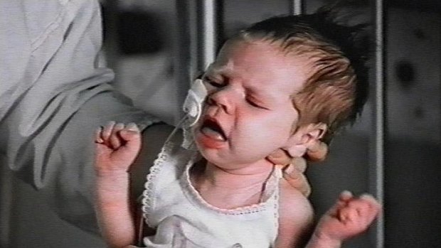 A baby struggles with the effects of whooping cough.