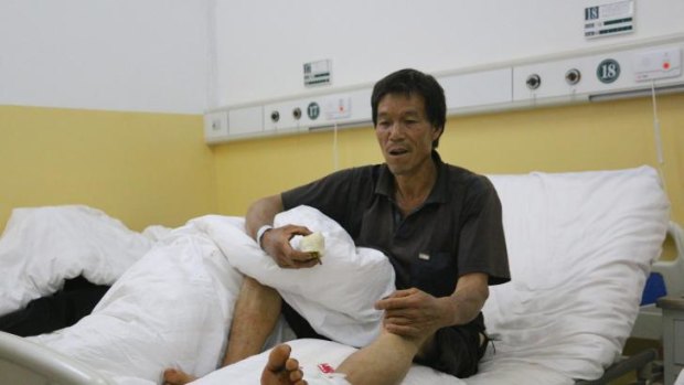 56-year-old Xiao Jinrong was sorting peppers when the earthquake hit and a falling wall shattered his ankle.