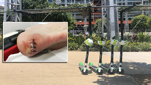 Jordan Madigan's heel was ripped open by a Lime scooter in Brisbane in January.