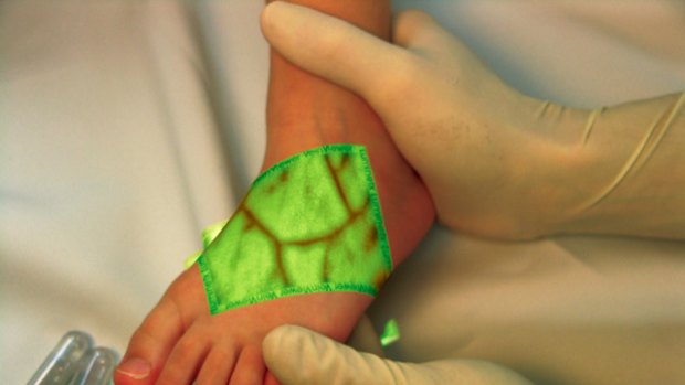 What lies beneath ... they VeinViewer displays infra-red images of blood vessels on the skin.