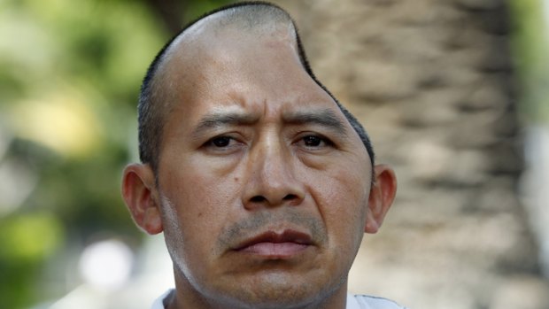 Antonio Lopez Chaj, 43, lost a quarter of his skull in the brutal attack.