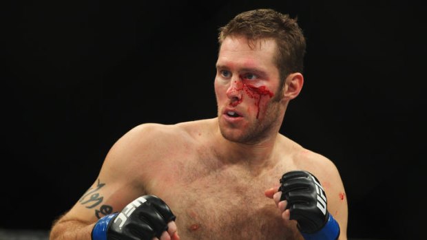 Nick Penner of Canada bleeds from a cut under his left eye.