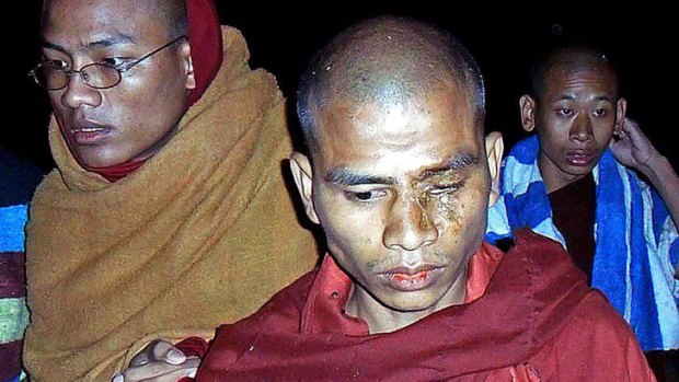 Crackdown ... this Buddhist monk suffered burn injuries when police fired water cannon and tear-gas at villagers and monks protesting against a Chinese-backed copper mine, in Monywa, northern Myanmar on Thursday.