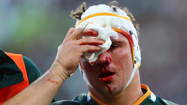 Battle scarred ... Heinrich Brussow, one of the Springboks' best players, spent nine minutes off the field in the bloddbin.