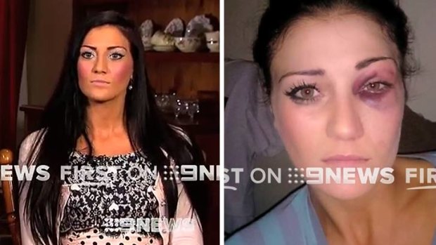 Katie Lewis, who claims to have been assaulted by NRL player Ben Te'o.