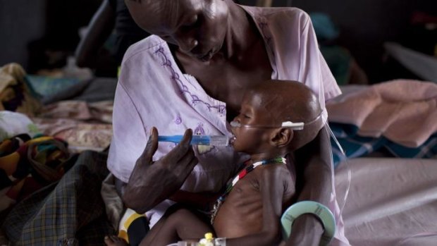 A child suffering from malnutrition is treated at a medical camp in March run by Medecins Sans Frontieres.