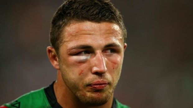 Double fracture: Sam Burgess played on with a fractured cheekbone and eye socket, which have required four face plates.