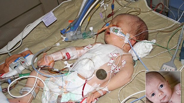 Xavier Horsley was born premature with an undiagnosed heart condition and had to undergo lifesaving surgery. Seven months later and he is full of life.