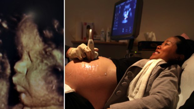 Relieved to feel her baby... Helen Kang has her third-trimester ultrasound. Left: a 3D ultrasound image of her child. New research has found that women can identify only about a third of foetus movements.