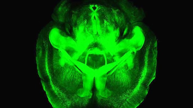  intact mouse brain 