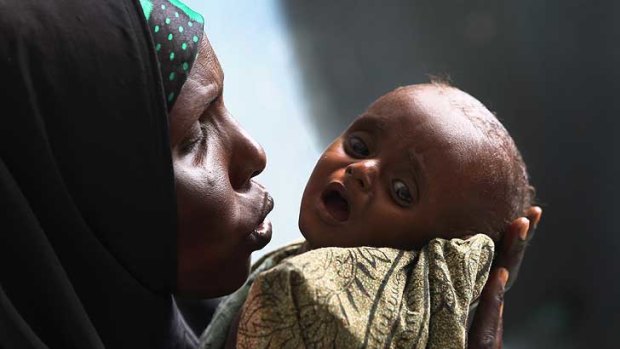 Halima Hassan comforts her severely malnourished son Abdulrahman Abshir, 7 months, at the Banadir hospital  in Mogadishu.