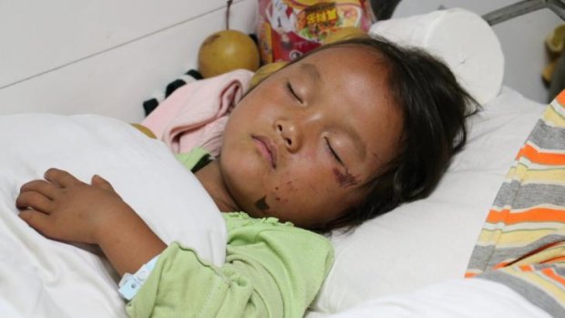 A child victim of the earthquake at Ludian People's Hospital.