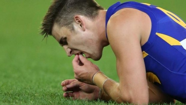West Coast's Elliot Yeo lost part of two front teeth during Saturday's loss to Collingwood.