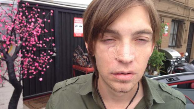 This image released by The Calling shows bandaged  lead singer Alex Band of the group The Calling in Los Angeles after an alleged assault near Detroit.
