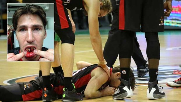 Down and out: The elbow left Damian Martin with three loose teeth and a broken jaw.
