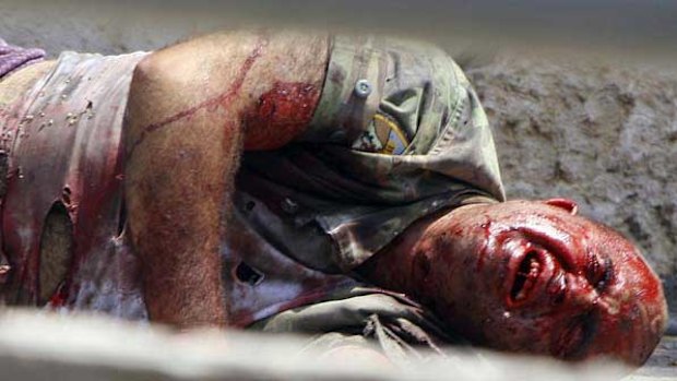 A Lebanese soldier wounded by an Israeli tank at Adaisseh village, southern Lebanon.