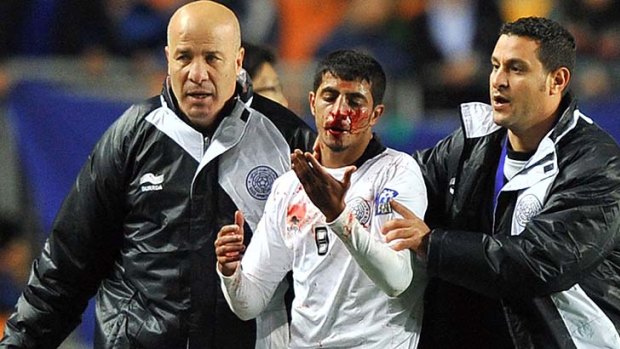 Scuffle ... Al Sadd midfielder Mesaad Ali walks off the pitch with a bloody nose.