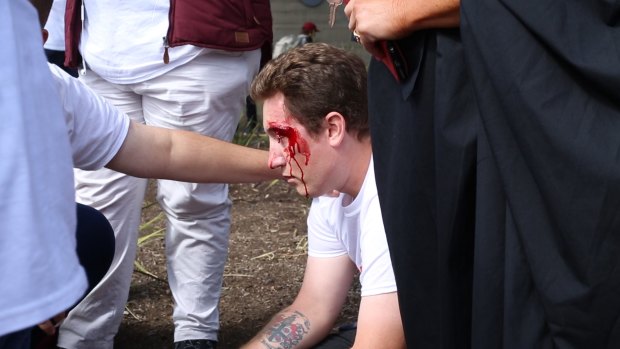 A man suffers a nasty head injury at Sunday's anti-Halal protest.