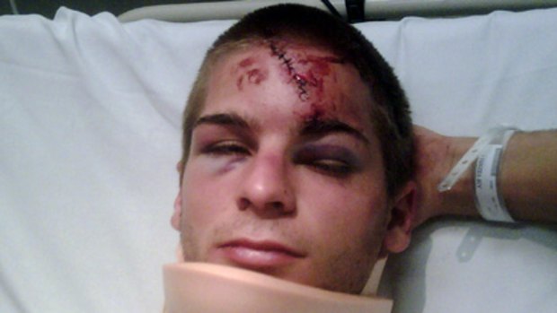 Luke, 19, recovers in hospital after an alleged bashing on Chapel Street.