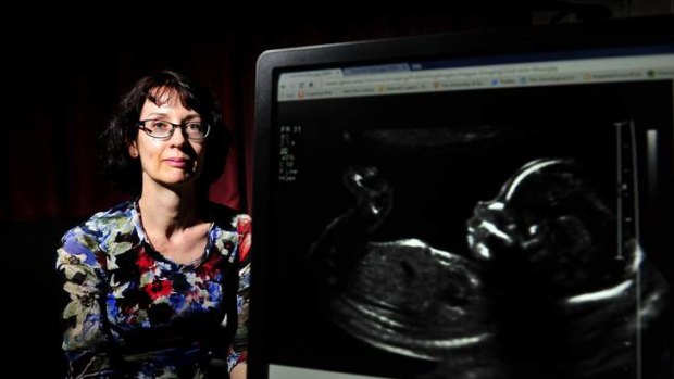 University of Canberra centenary resident professor of faculty arts and design Deborah Lupton talks about parents showing ultrasound's of their children on social media.
