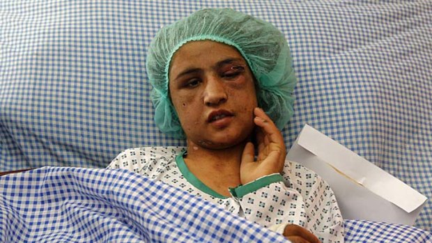 Ordeal: Sahar Gul, 15, was tortured by her in-laws.