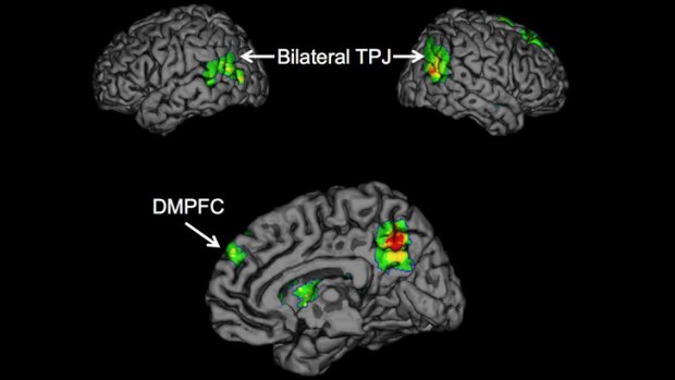 The temporoparietal junction (TPJ) and dorsomedial prefrontal cortex (DMPFC) brain regions are associated with the successful spread of ideas, or "buzz".