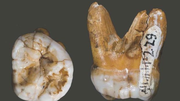 Remains of the day ... the tooth of a recently discovered human relative, Denisovan.