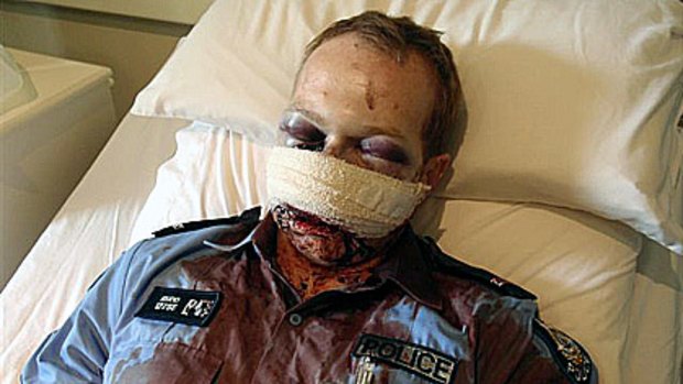 Constable David Rudd was injured while attending a disturbance at Wyndham on Christmas morning.