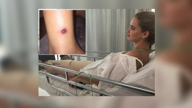 Jorji Harper was hospitalised because of a rare delayed reaction to a tiger snake bite.