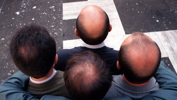 The bald truth... no current treatments for balding can actually create new hair.