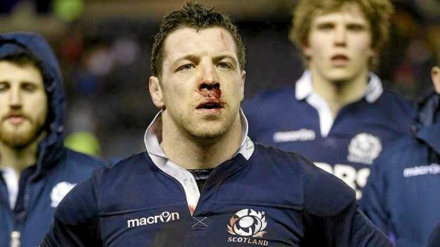 Scotland the ... The Scots were held pointless at Murrayfield for the first time in decades.