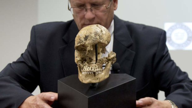 Doug Owsley of the Smithsonian's National Museum of Natural History displays the skull of  "Jane of Jamestown". The bones of Jane show signs that she was cannibalised.