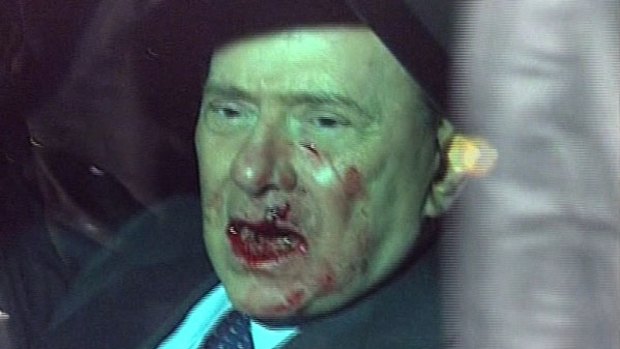 A TV image shows Mr Berlusconi seconds after the attack.