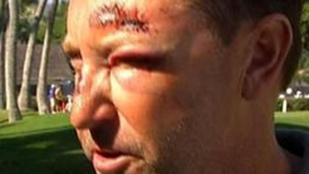 It has been a difficult year for Robert Allenby, who was attacked in Hawaii.