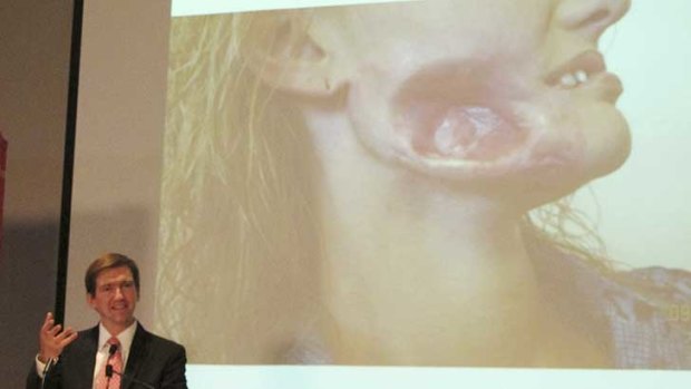 Dr Jarrod Little speaks at a news conference, showing images of Lessya Kotelevskaya's injuries.