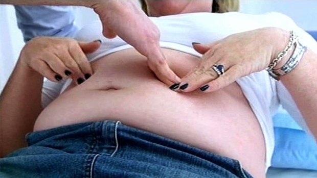 Dr Brad's mother-of-two Naomi has stomach muscles that split during pregnancy.