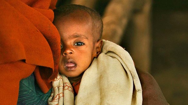 A 10-month-old Ethiopian child suffers malnutrition while the rich speculate on food prices.