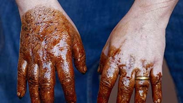 Oil and water, scooped up with a bucket from the Gulf of Mexico off the side of the supply vessel Joe Griffin, is seen on the hands of an AP reporter at the site of the Deepwater Horizon oil spill.