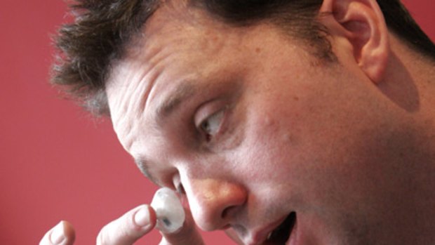 Spence shows his prosthetic eye during an interview in 2009.